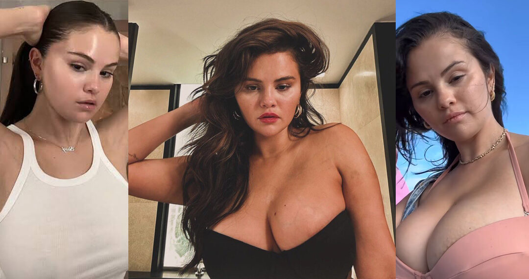 Botulismo, la enfermedad de Selena Gomez