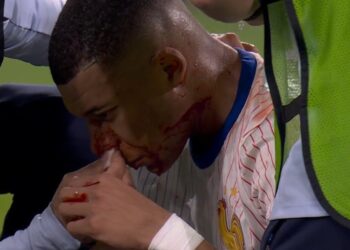 Alarmas en Francia y en Madrid, Mbappé se fracturó